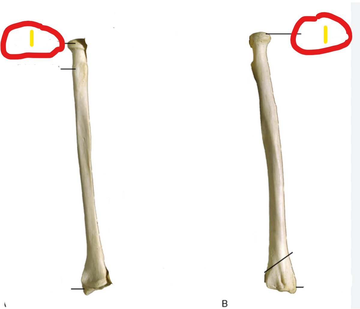 <p>what bone is this?</p>