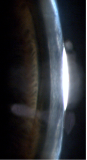 <p>what grading </p>