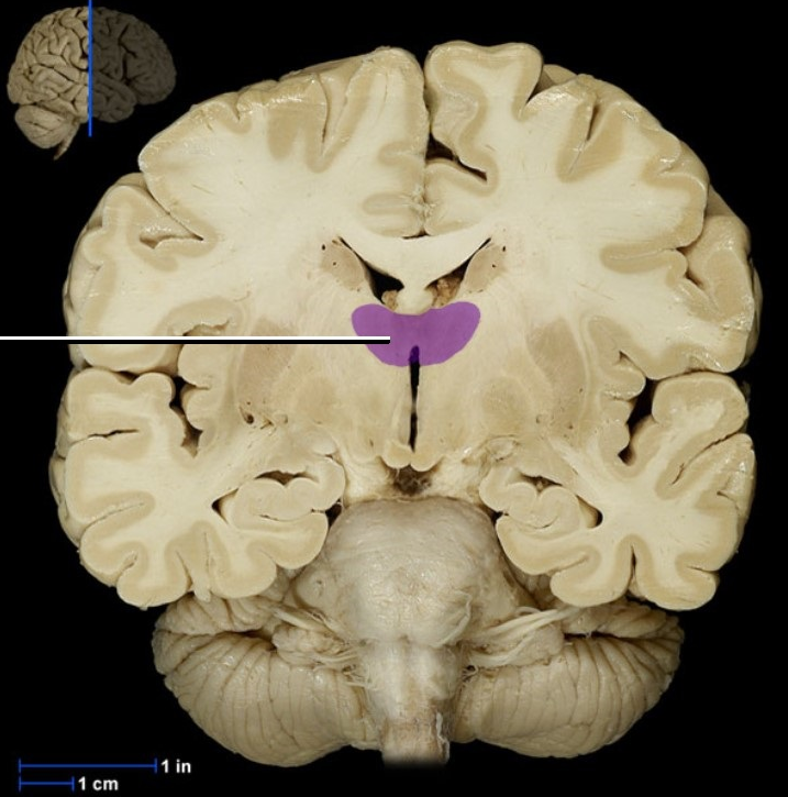 <p><span><span>Thalamus</span></span></p>