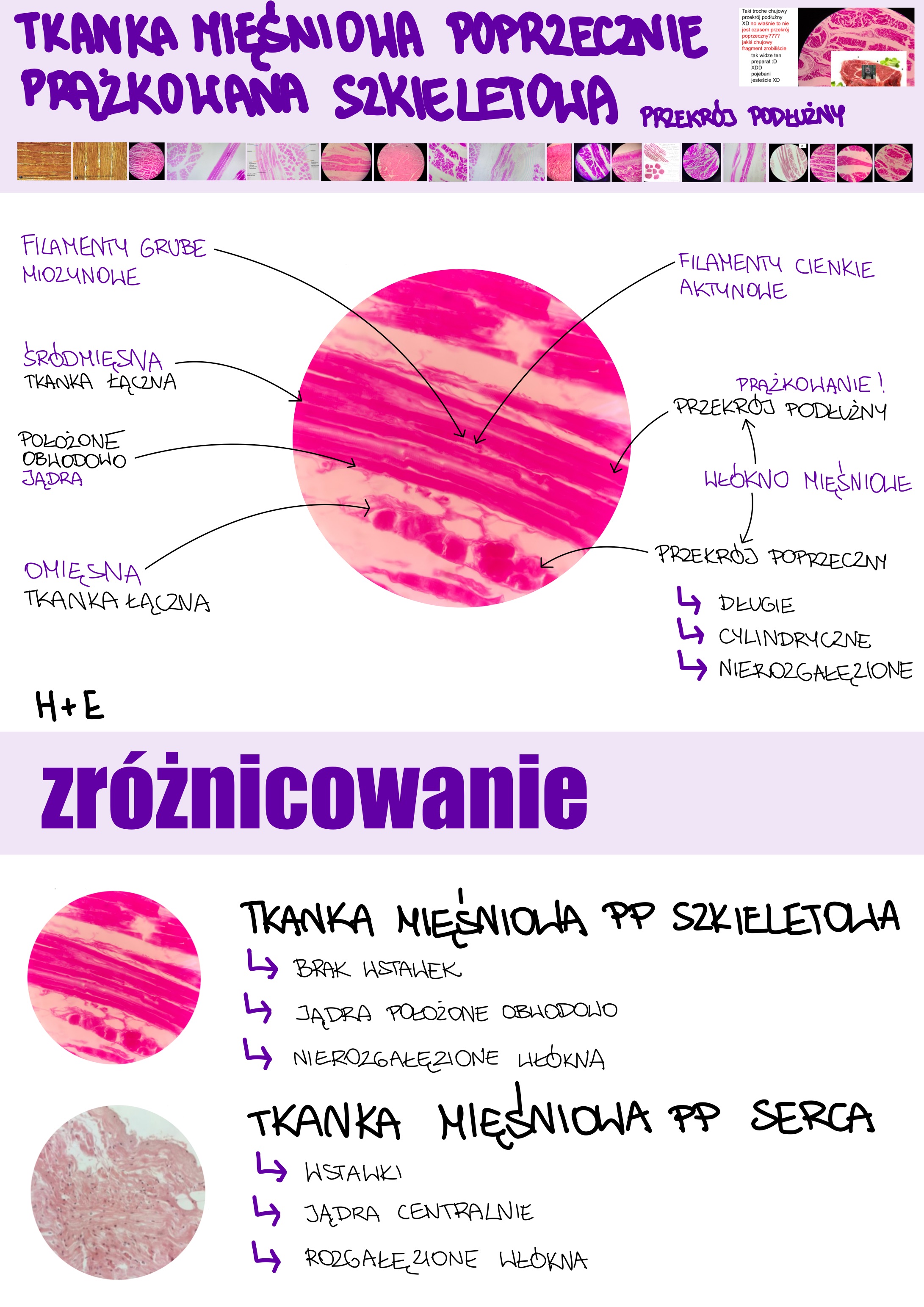 <p>Tkanka mięśniowa poprzecznie prążkowana szkieletowa</p>