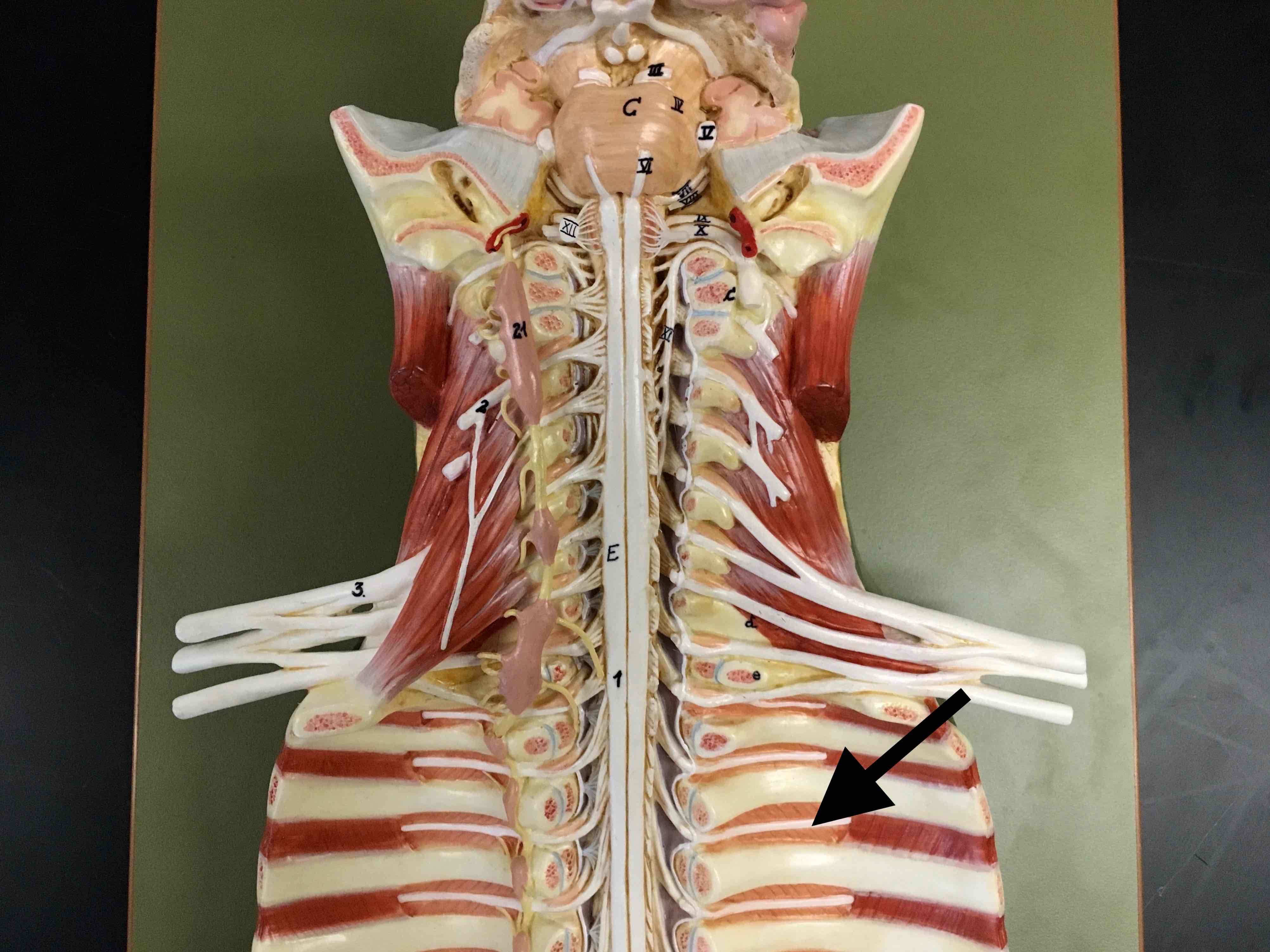 <p>name the specific white structure</p>