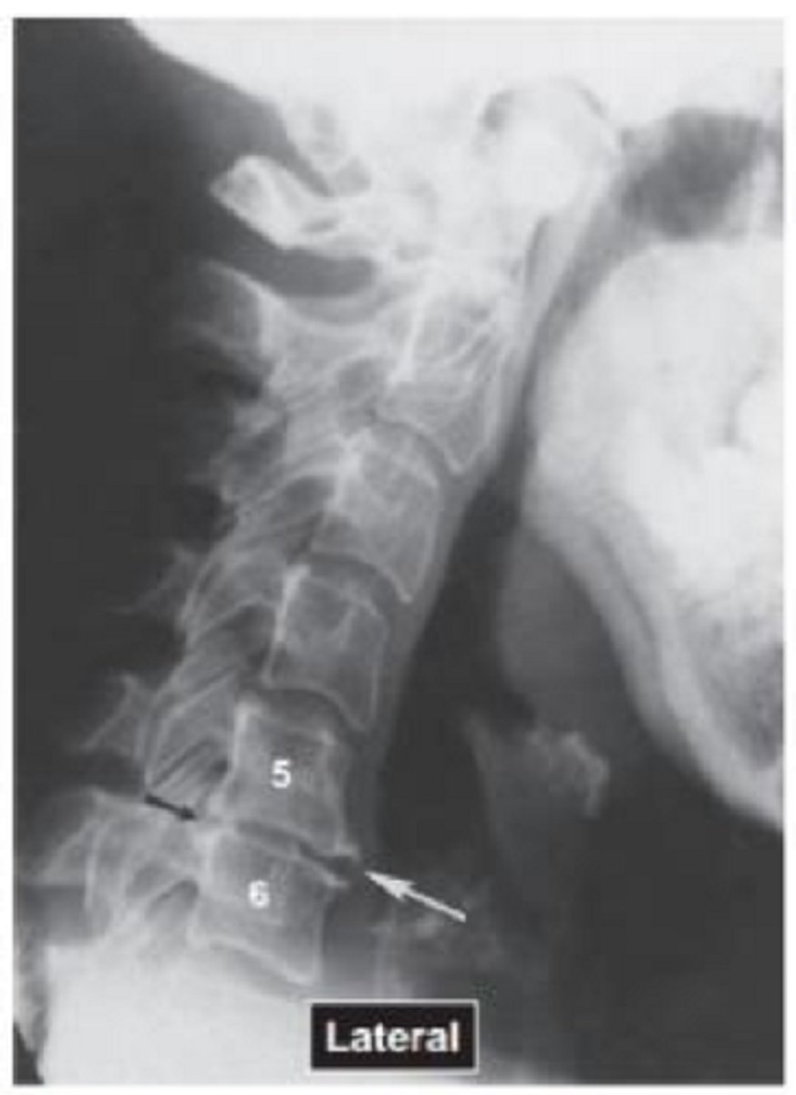 <p>Name the pathology</p>