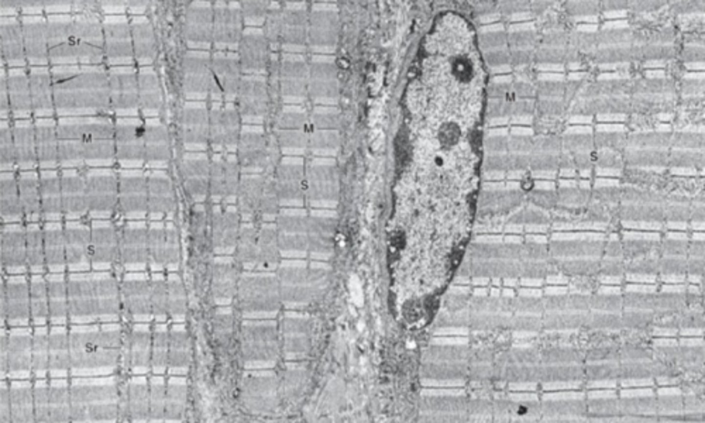 <p>What cell structures are found in between myofibrils?</p>