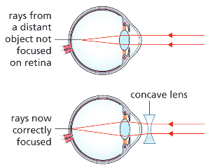 <p>They spread out the light from distant objects so it is in perfect focus on the retina.</p>