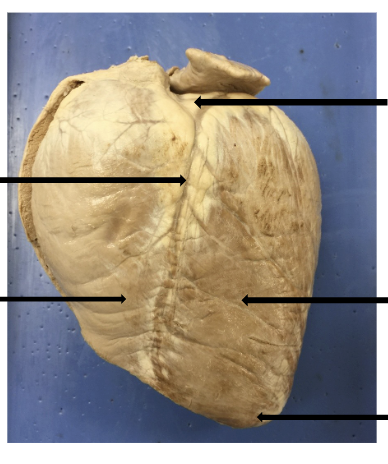 <p>Label from top to bottom</p>