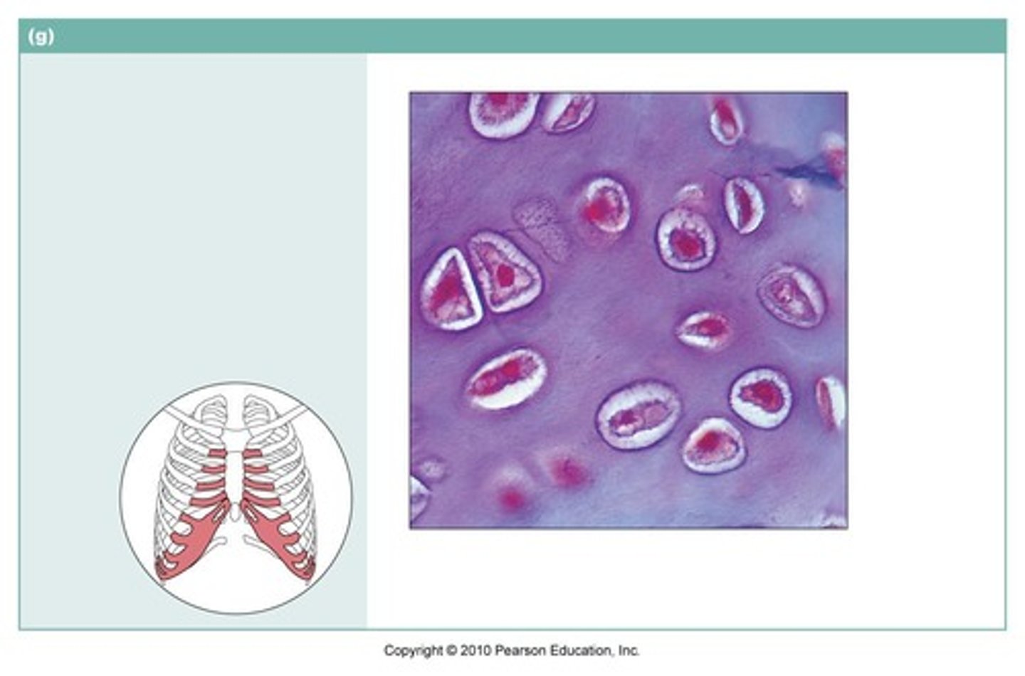 <p>Cell Chondro-cyte</p><p>Matrix Collagen fibers not evident</p><p>Function: Supports and reinforces, provides a framework</p><p>Location: covers the ends of bones, costal cartilage in ribs, nose, rings in trachea, and larynx, forms most of the embryonic skeleton</p>