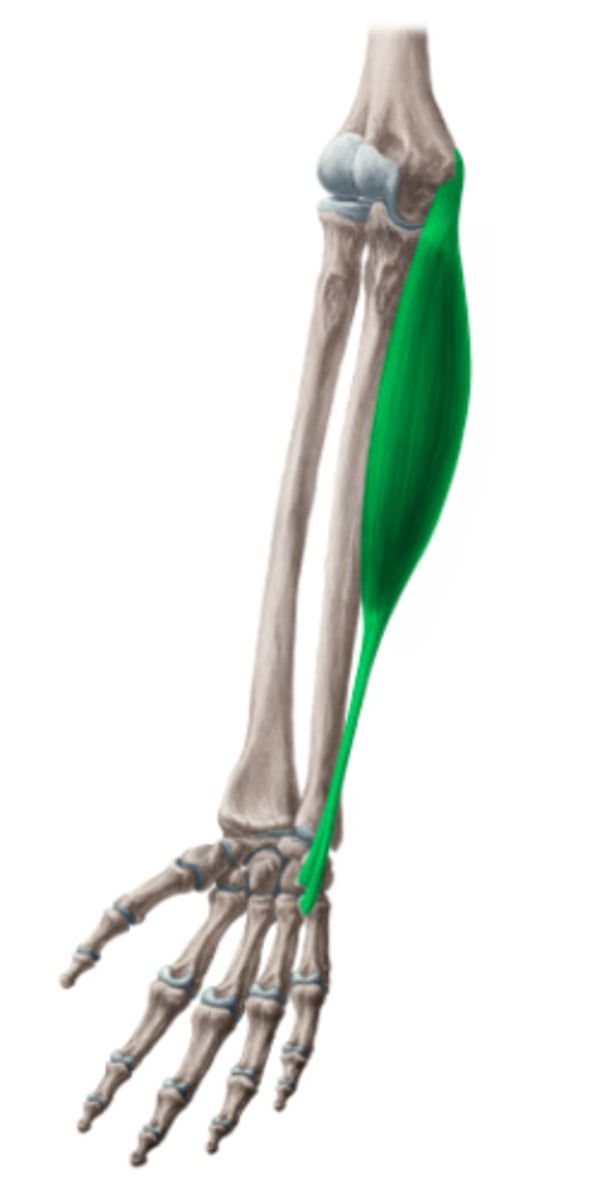 <p>Welke spier is dit?</p>