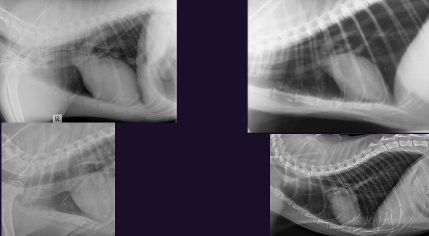 <p>Lateral view only</p><p>Separation of the blood vessels on lateral view</p>
