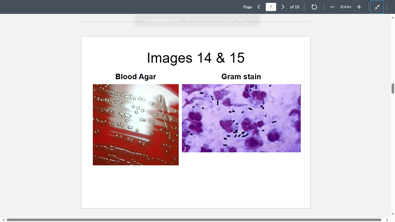 <p>A 70-year-old resident of a nursing home has developed fever, productive cough and difficulty breathing. His chest X-ray shows an area of consolidation in the right lower lobe of the lung. The patient’s sputum yields these organisms (Images 14&15). He is diagnosed with pneumonia, most likely caused by which of the following?</p>