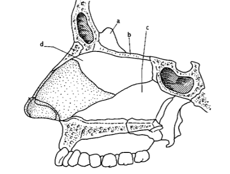 <p>99. _____ process of lower portion ethmoid bone</p>