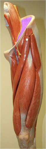 <p>Identify the muscle.</p>