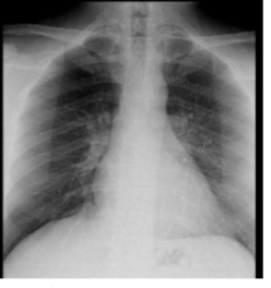 <p>What is this </p><p></p>