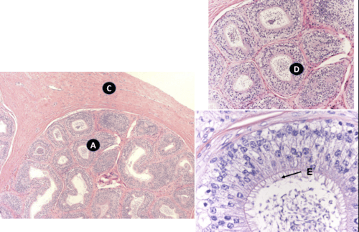 <p>d: epithelium type</p>