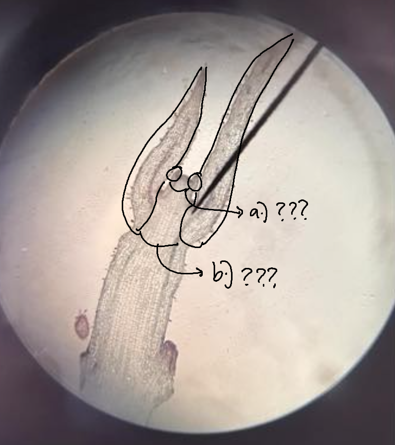 <p><span>part of SAM under microscope; groups of cells that will form into new leaves; can be young (smaller) or old (bigger)</span></p>