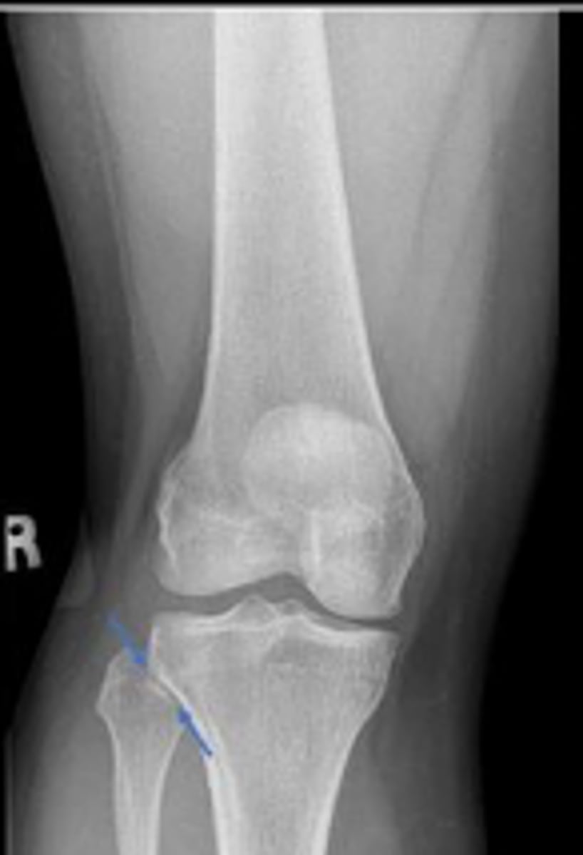 <p>What space are the arrows pointing to?</p>