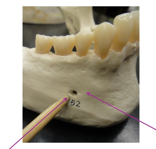 <p>What bone structure is the arrow pointing to?</p>