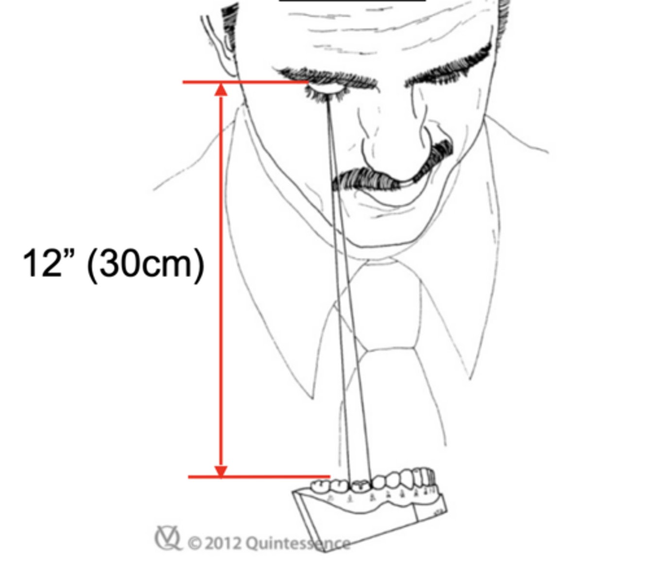 <p>T/F: To examine a preparation for undercuts, one eye should be closed.</p>