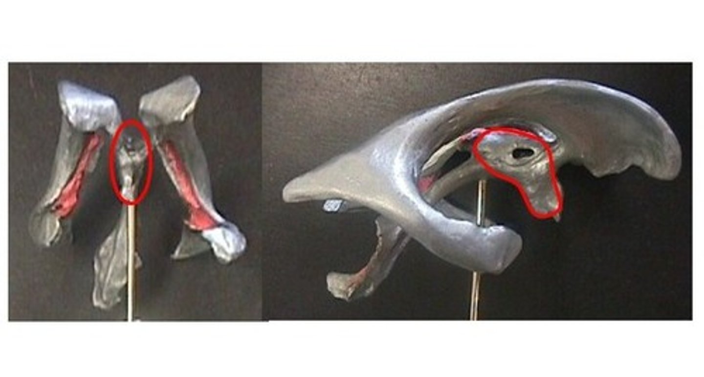 <p>-Narrow medial space beneath corpus callosum</p><p>-Connects to cerebral aqueduct</p>