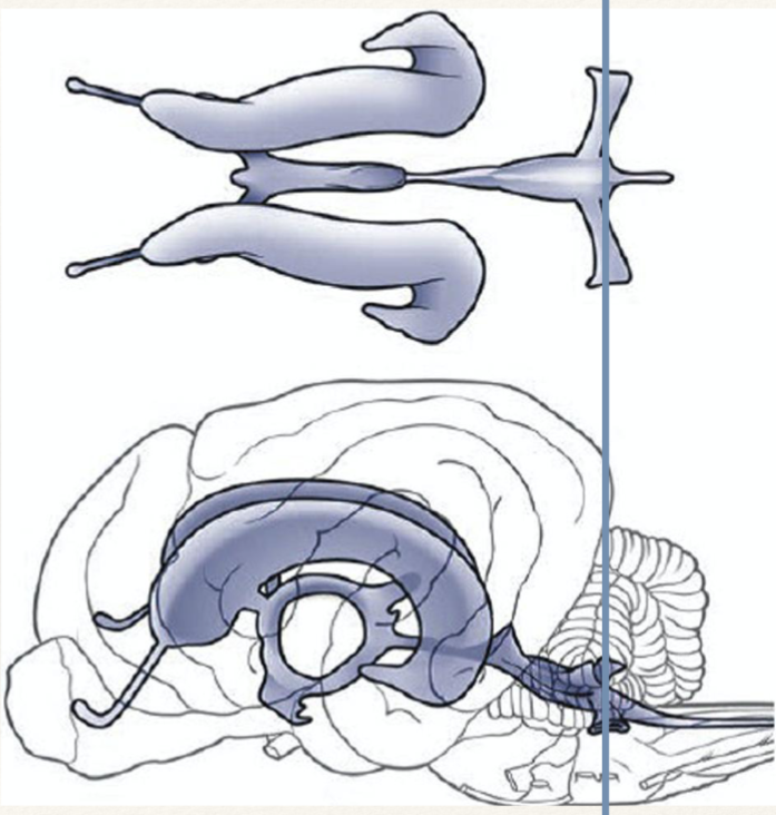 <p>what ventricle is the line passing through?</p>