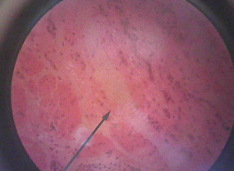 <p>What makes it tough? Keratin</p><p>Location: Lining of the mouth, anus, and vagina</p><p>Function: To secrete and protect</p>