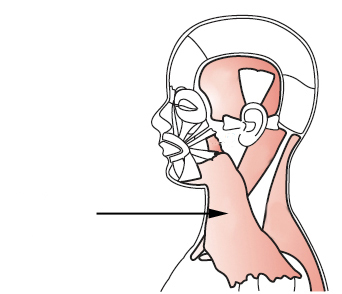 Which muscle, illustrated below, draws the lower lip and corner of the mouth sideways and down, partially opening the mouth, as in surprise or fright?