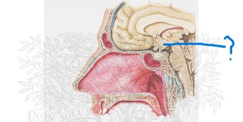 <p>What is the arrow pointing to?</p>