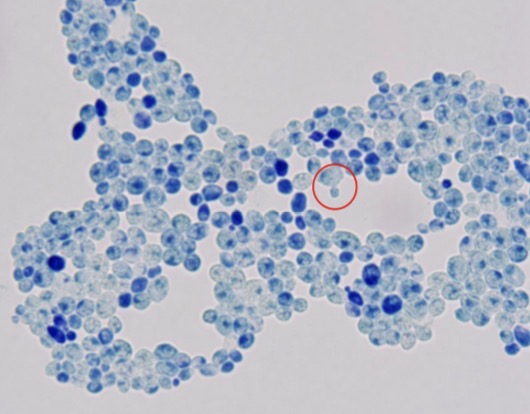 <p>Genus: Saccharomyces</p>