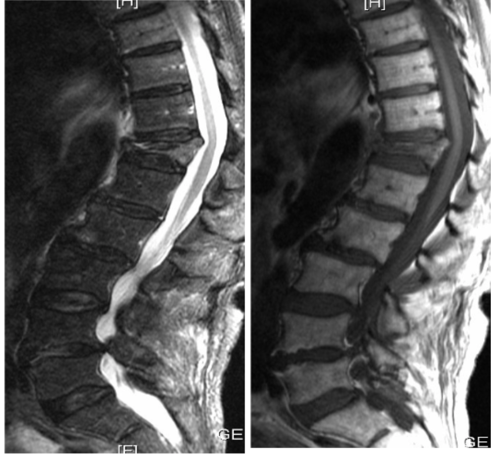 <p>Name the main (bony) pathology. </p>