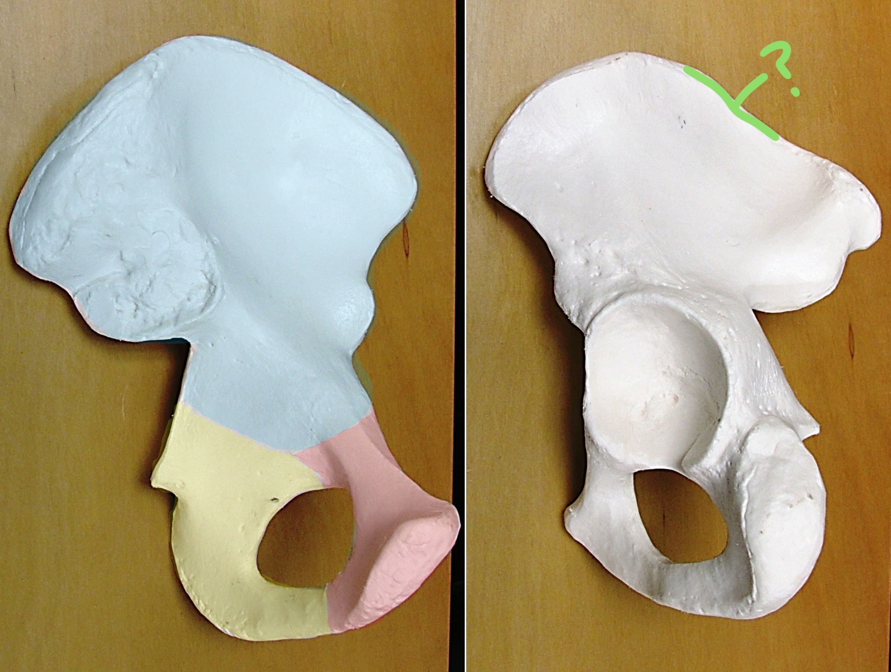 <p>Determine the part of the Coxa highlighted</p>