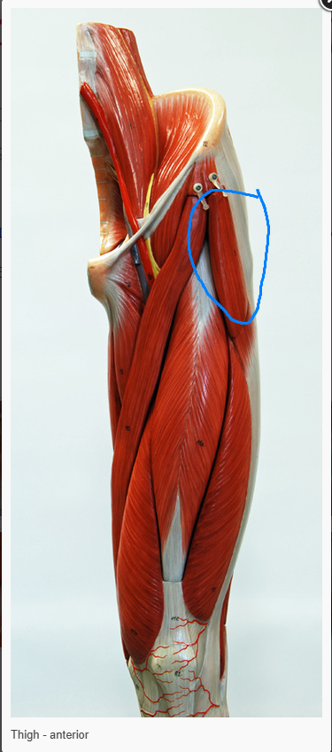 <p>what is the name of the muscle circled </p>