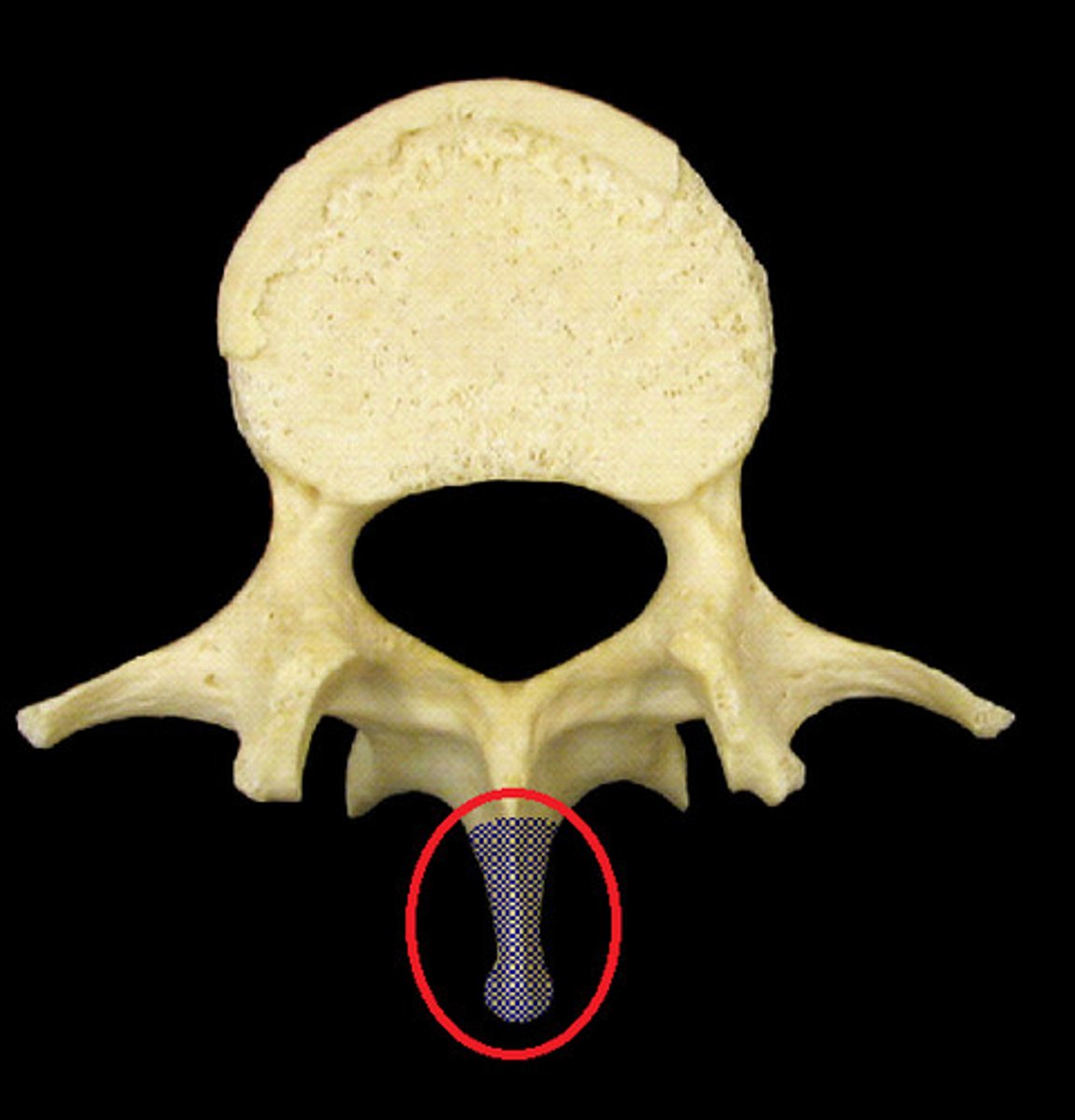 <p>sharp, narrow, posterior projection from vertebral bones. Used for muscle attachements</p>