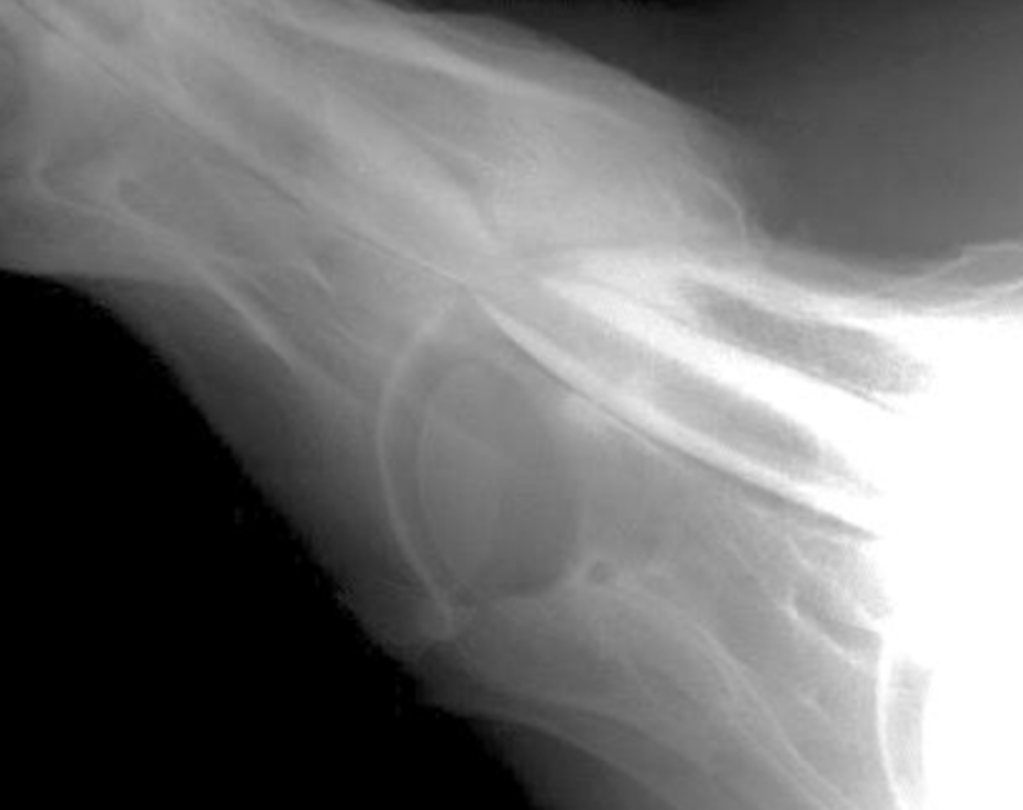 <p>What is the pathology?</p>
