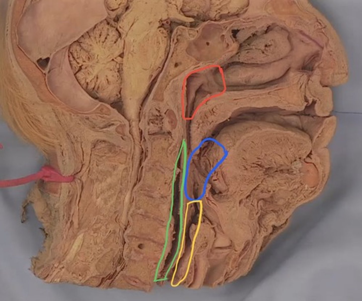 <p>What part of the pharynx is outlined in red?</p>