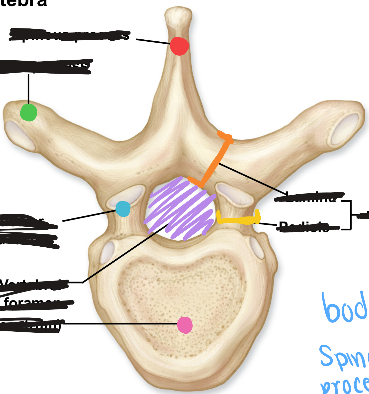 <p>What is the yellow protrusion?</p>