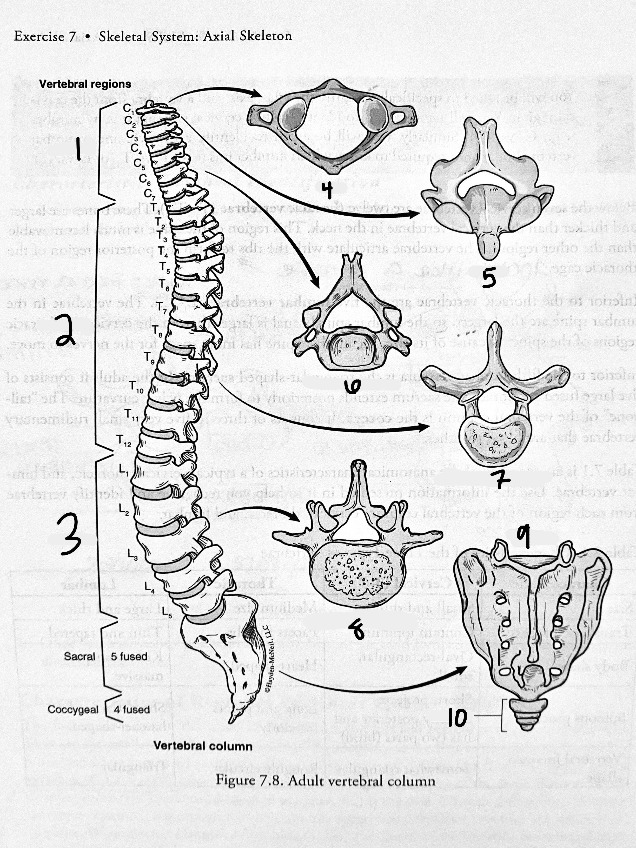 <p>Thoracic Region</p>