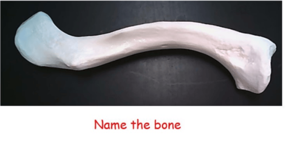 <p>name the bone </p>