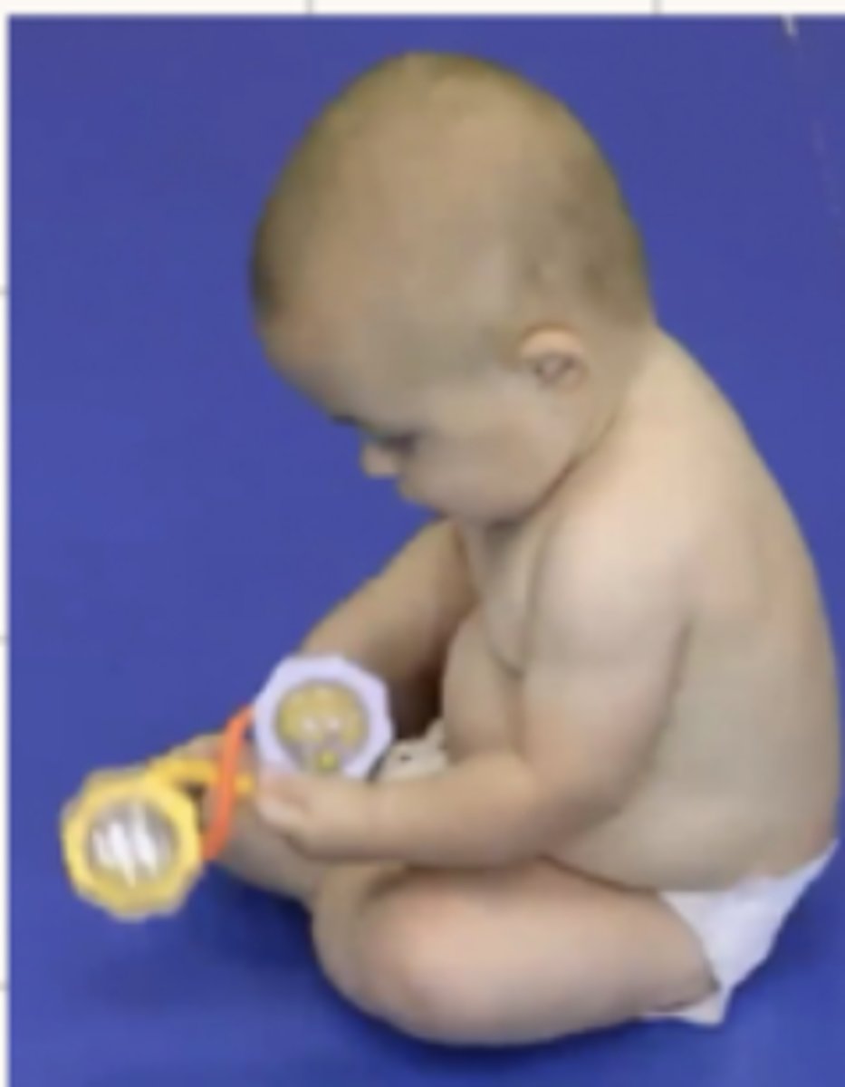 <p>6 months</p><p>Will probably be in a ring sit for a wide BOS for proximal stability</p><p>UE are free</p><p>Controls sagital WS</p>