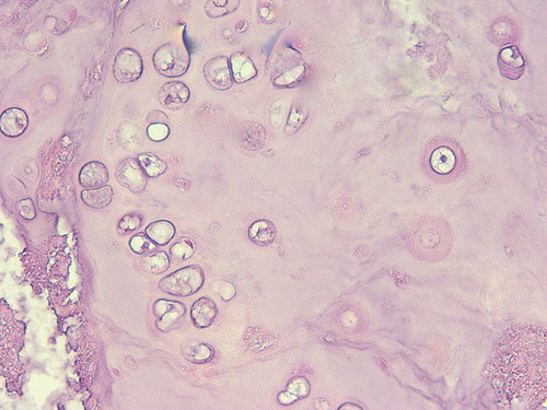 type of connective tissue, function, and location?