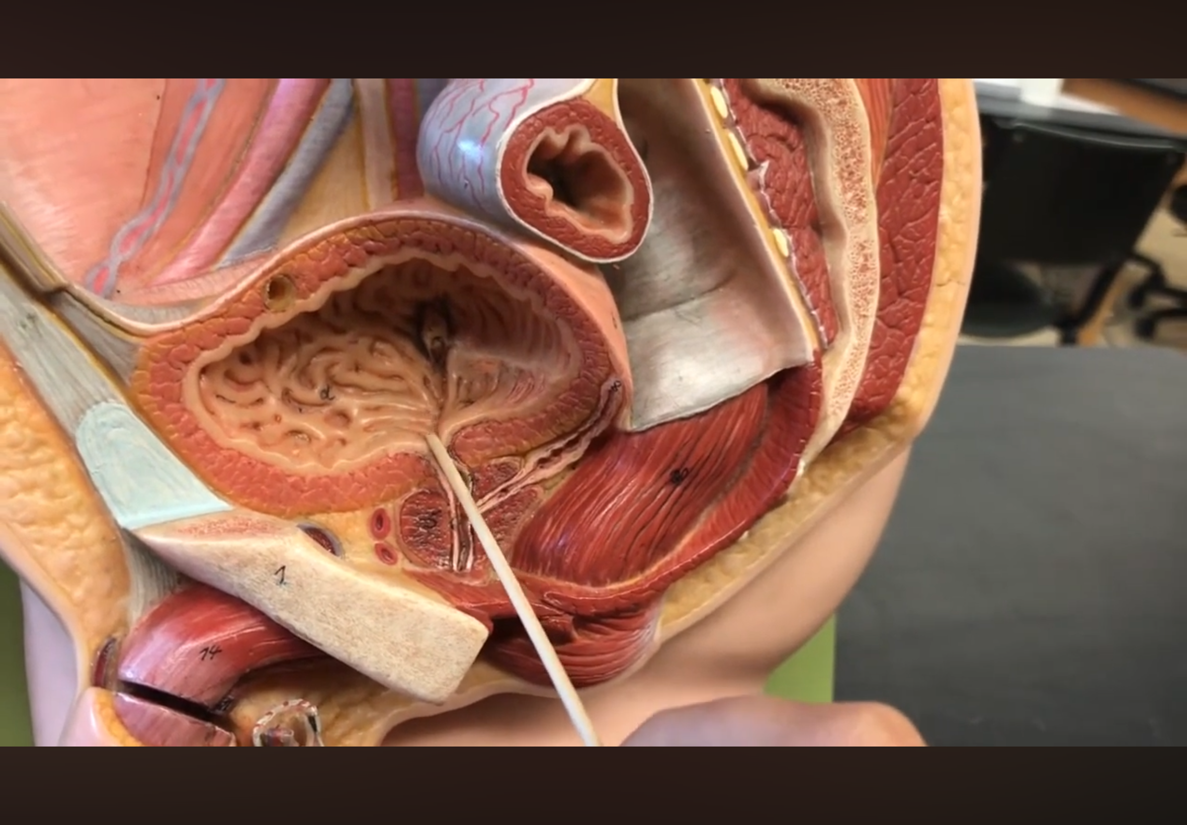<p>orifices and fundus “connected”</p>
