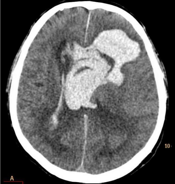 <p>5.2</p>