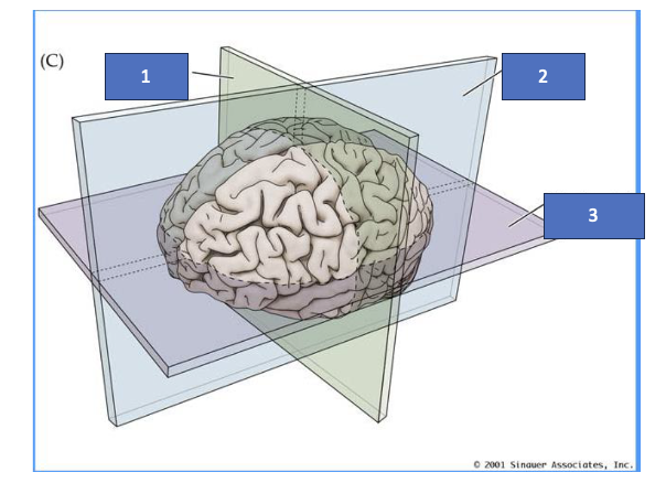 <p>What structure is labeled 1?</p>