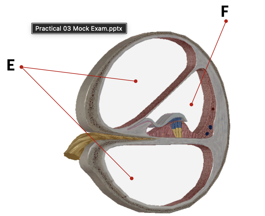 <p>what is bottom E?</p>