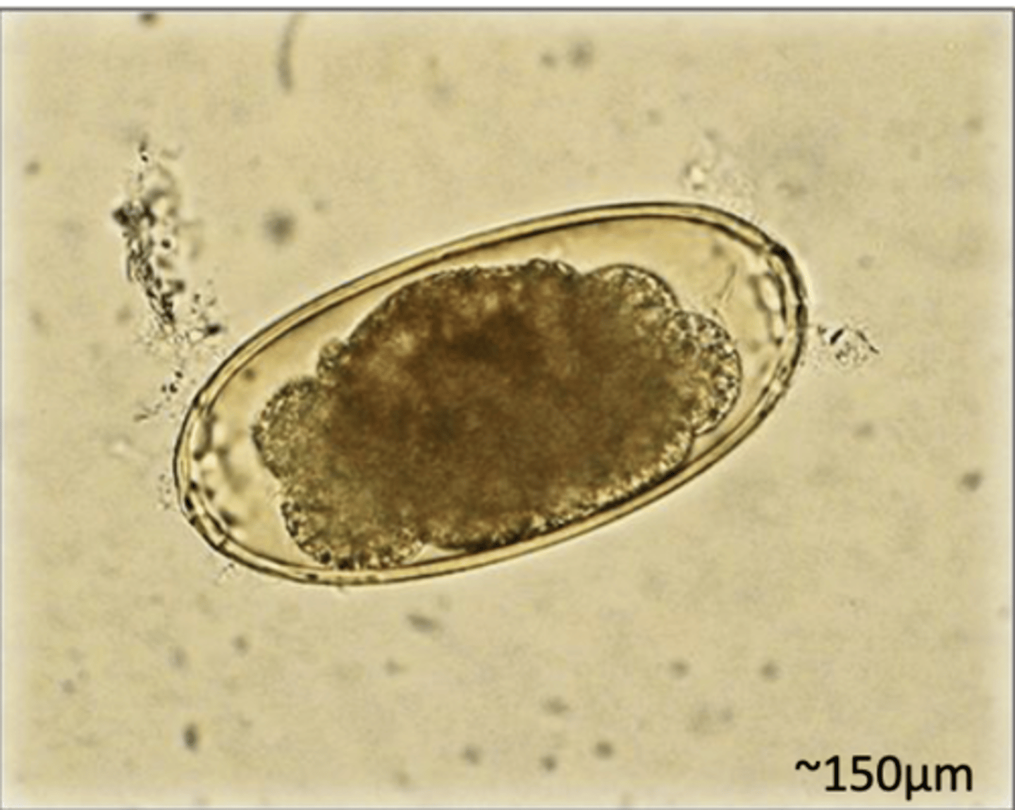 <p>What egg does this parasite belong to? What characteristic/s did you use to identify it?</p>