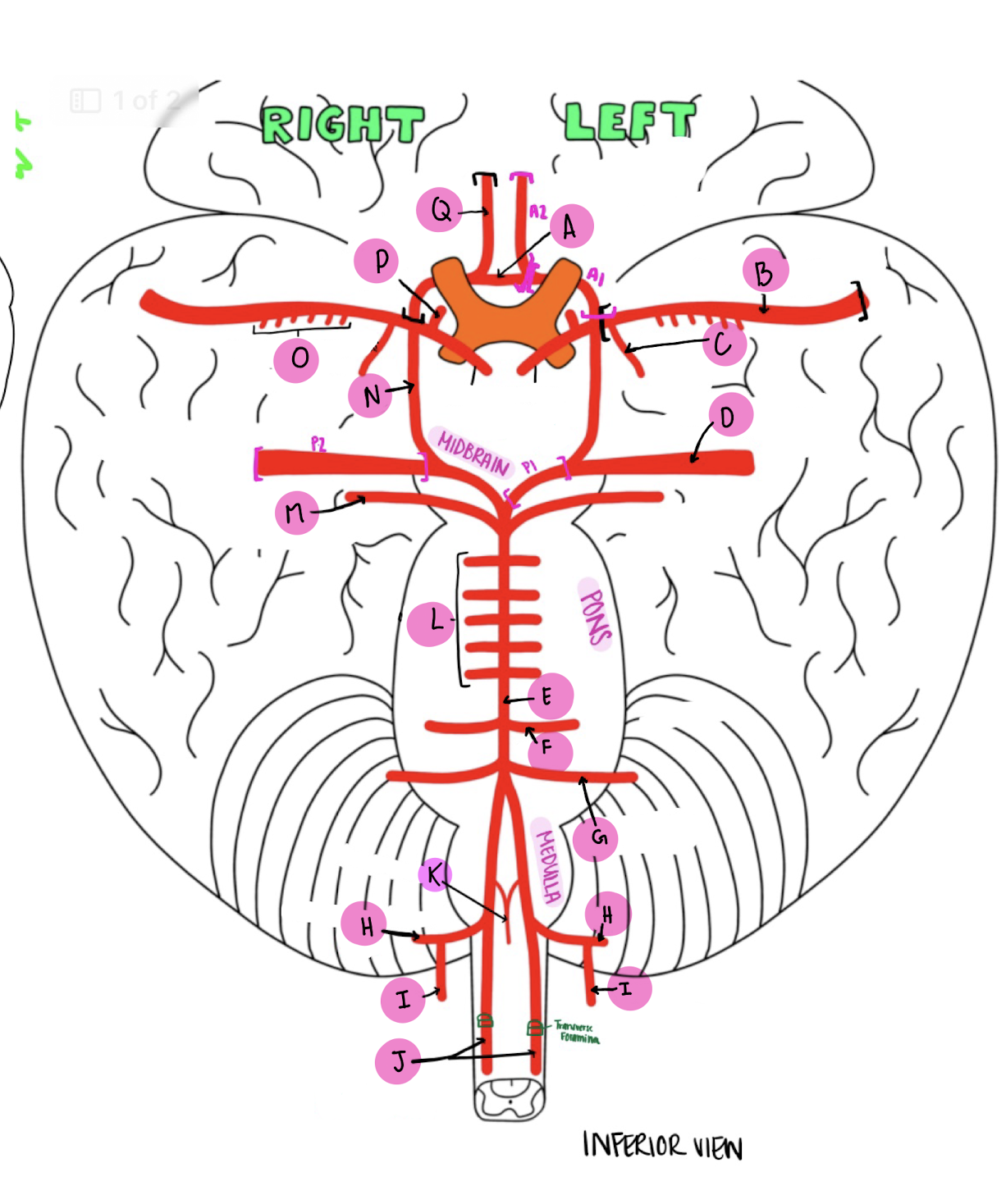 <p>What artery is labeled B?</p>