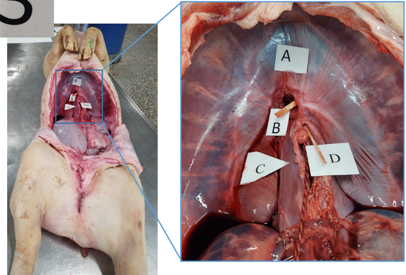 <p><strong>Post 3.</strong></p><p><strong>Spørgsmål 1:</strong> Benævn den del af diaphragma, som udgøres af A</p>