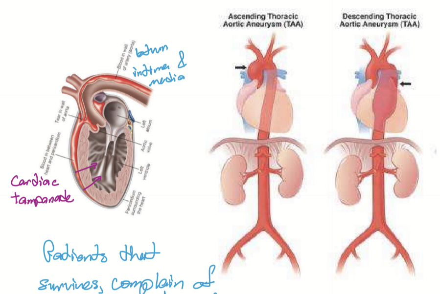 <p>Any part of the thoracic aorta.</p>
