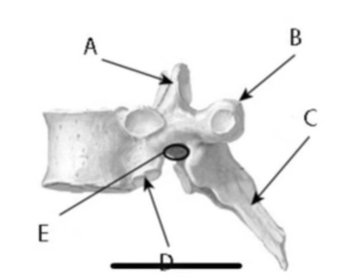 <p>Label the anatomy indicated by letter D:</p><p>(What surface of bone?)</p>