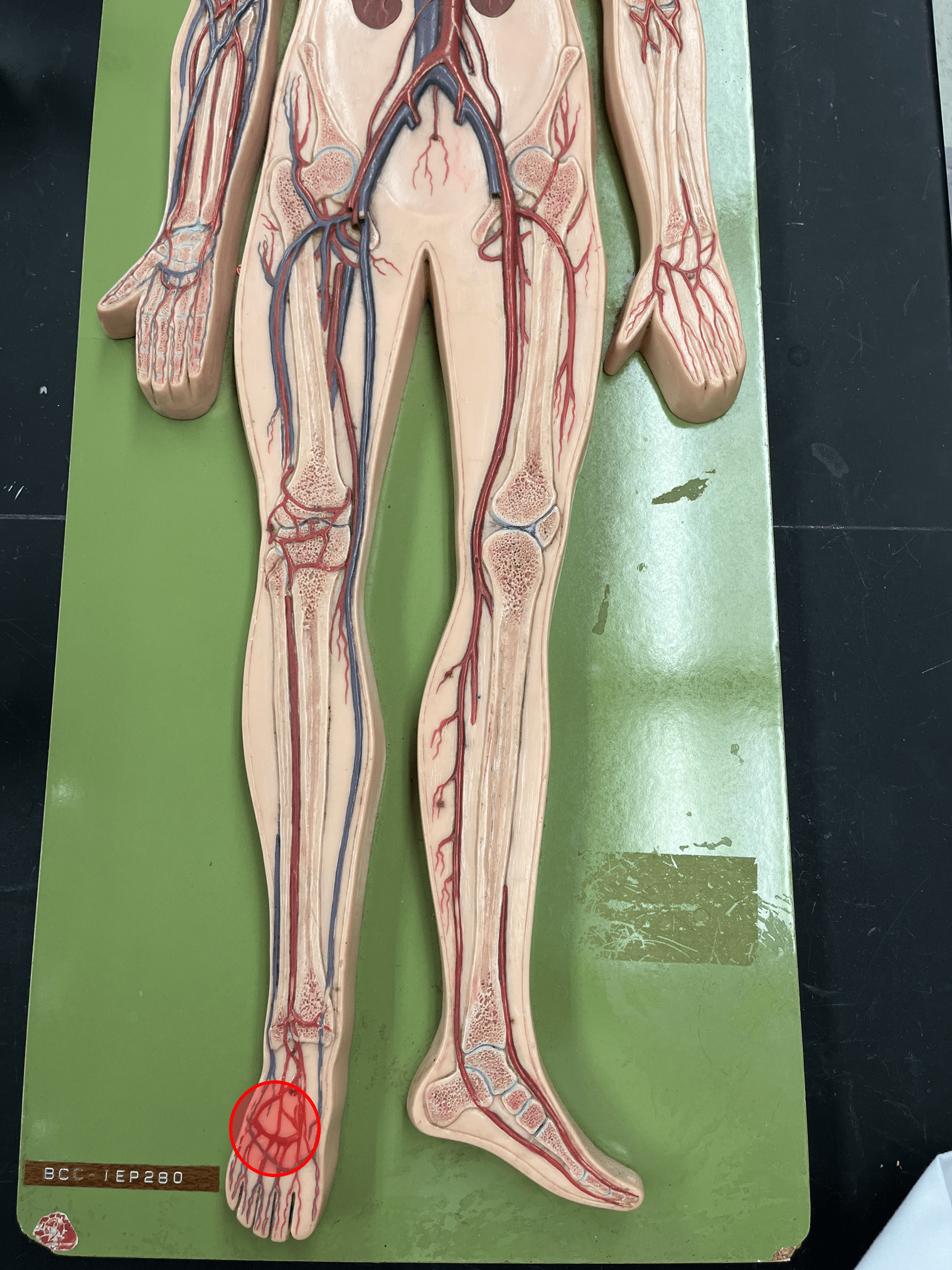 <p>• An artery of the lower limb.</p>
<p>• Originates from the dorsal pedal artery.</p>
<p>• Supplies the foot.</p>