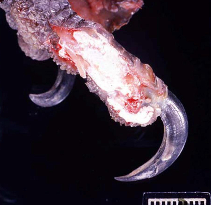<p>what is being shown in this foot**</p>