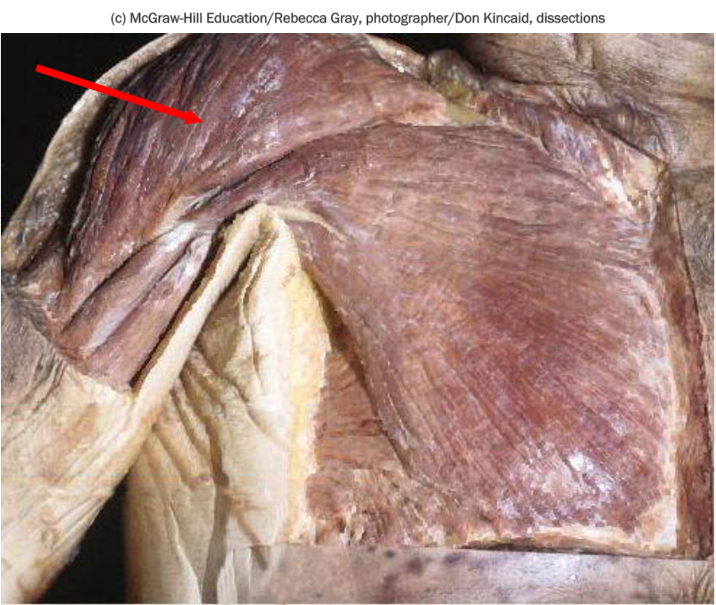 <p>What os the indicated muscle of the shoulder</p>